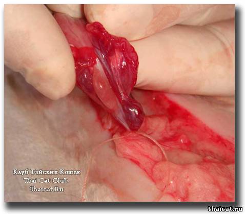 овариоэктомия